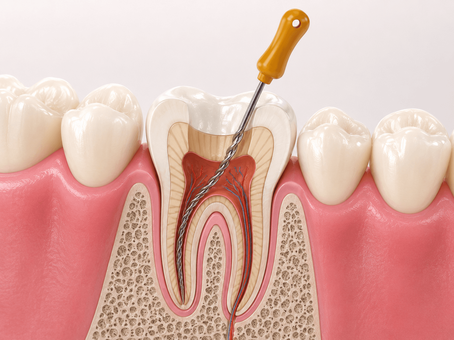Endodonti
